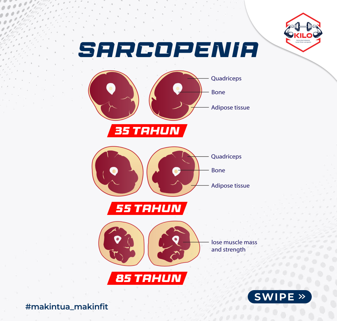SARCOPENIA